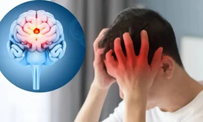 Early brain tumor symptoms including vision changes and neurological warning signs